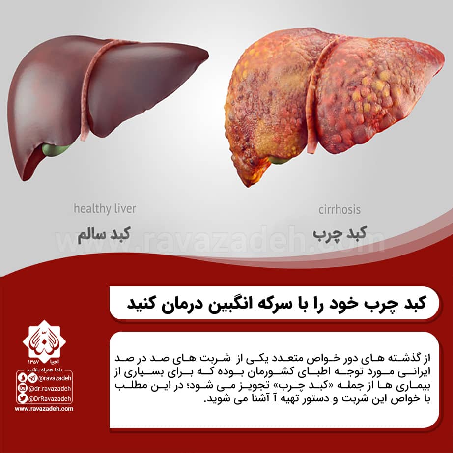 درمان کبد چرب با سرکه انگبین